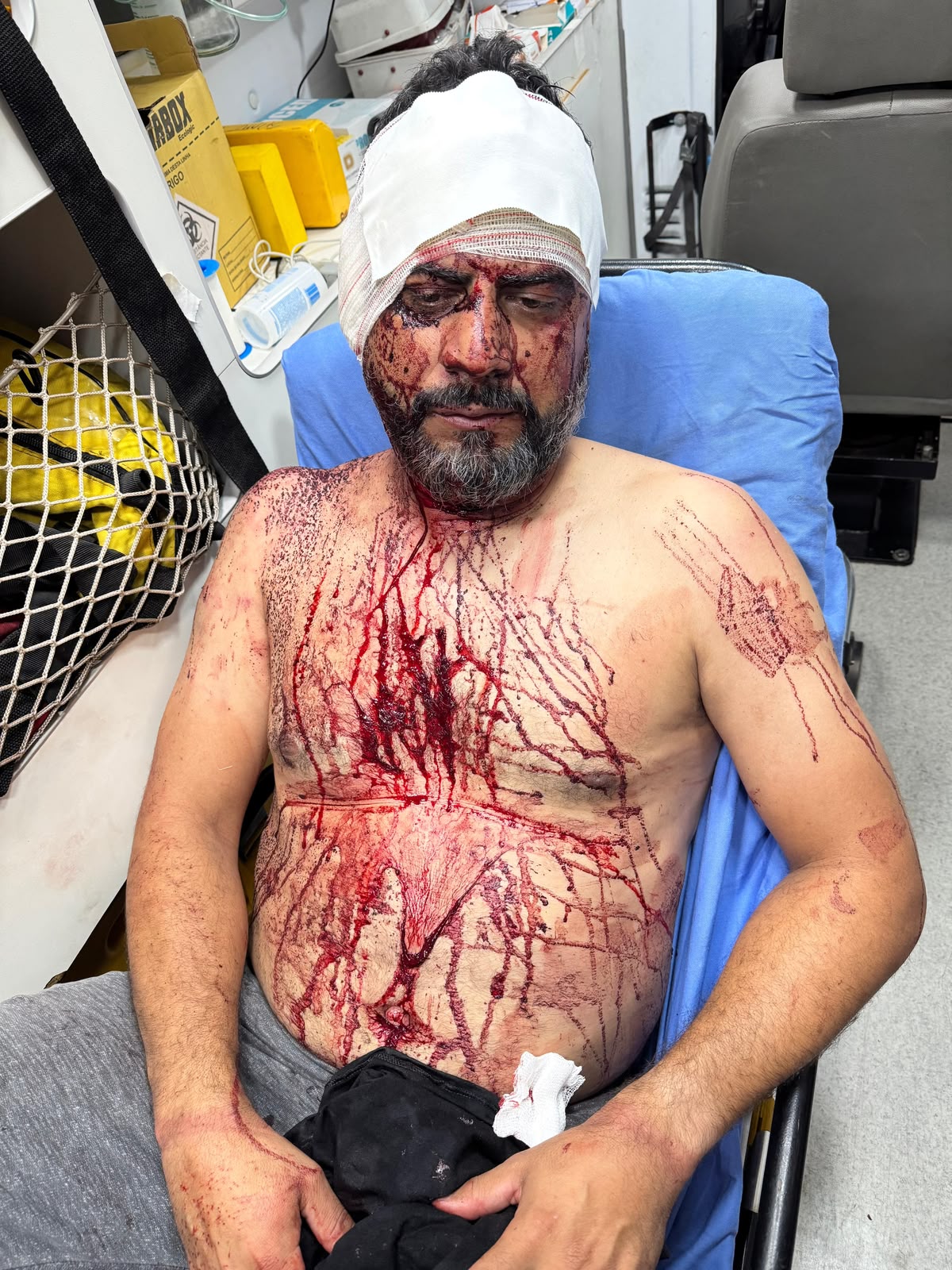 Rosto coberto de sangue: veja como ficou vereador após ataque em Rondonópolis